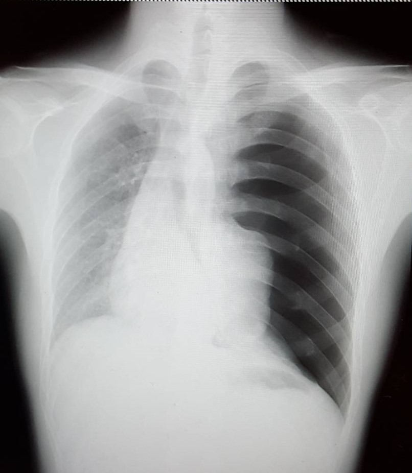 第30回　上野写真①