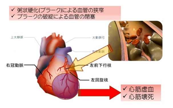 各診療科(心臓血管外科)写真5