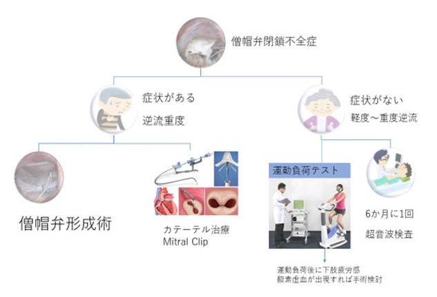 各診療科(心臓血管外科)写真13