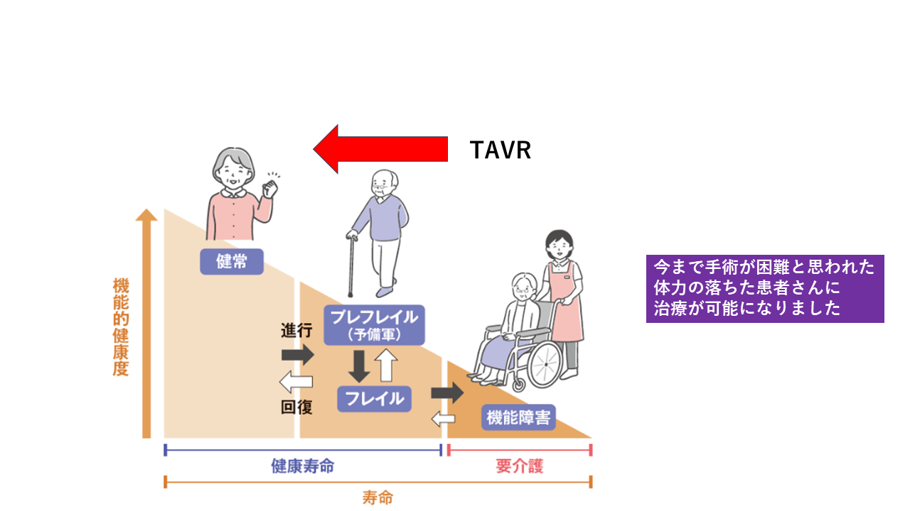 TAVR