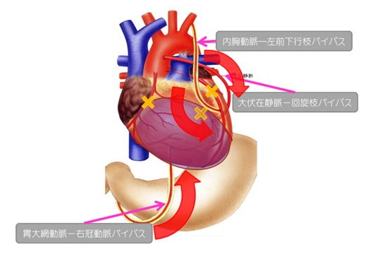 各診療科(心臓血管外科)写真7