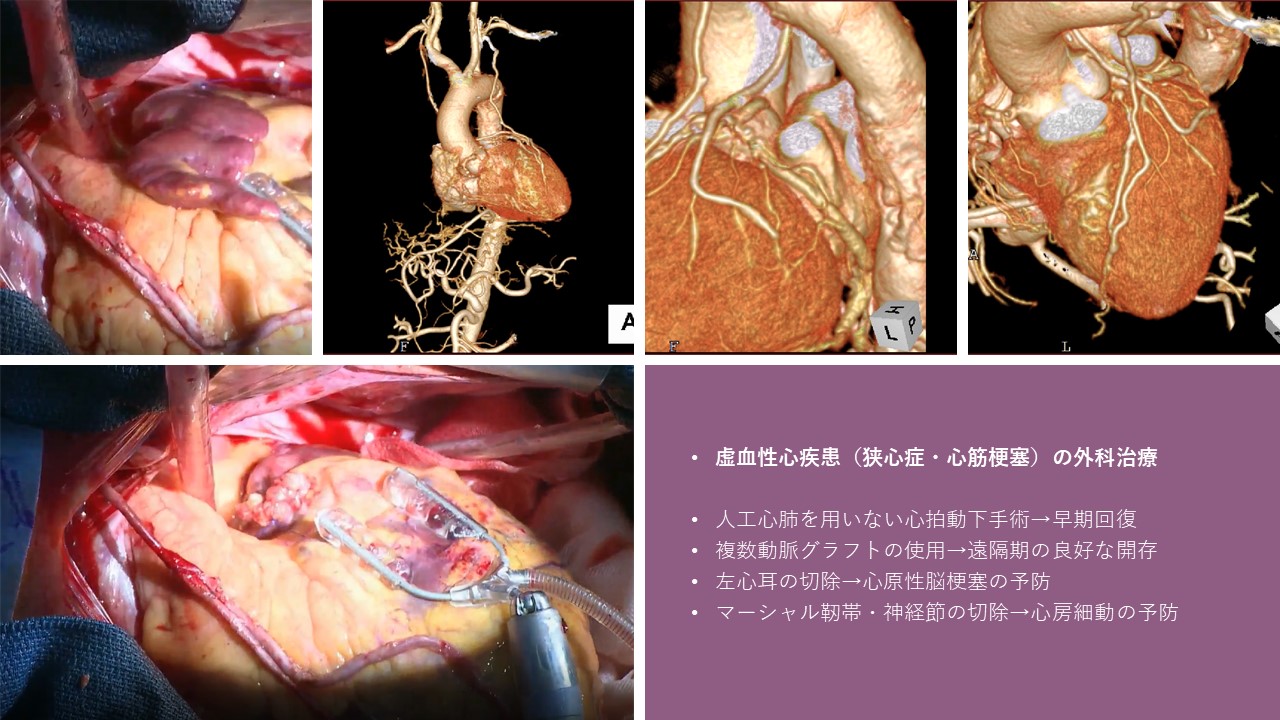 各診療科(心臓血管外科)写真8
