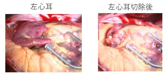 各診療科(心臓血管外科)写真15